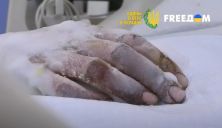 Раненый украинский военнослужащий ВСУ. Скриншот видео: uatv.ua
